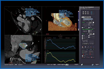 図6　TAVR/TAVI術前のAnnulus  diameterの評価