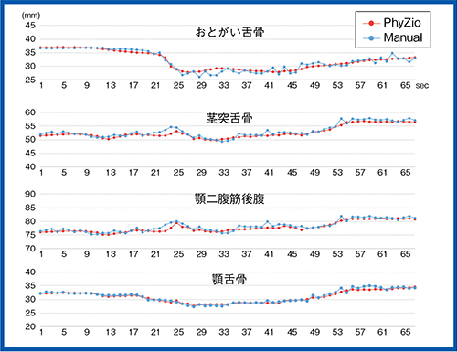 図5　ボクセルトラッキングと手動による計測の比較