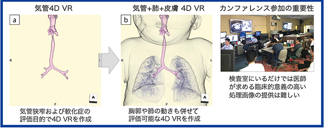 図2　カンファレンスと3D画像作成