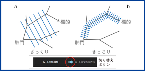 図3　オブリーク断面の使いどころ：輪切り表示 ざっくりと全体像を把握できるMPR像と，きっちり気管支の断面を表示できるルート直交断面表示を切り替えることで標的までの正しいルートを選択して分岐を詳細に確認できる。