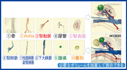 図2　REVORASのインフィニットマスク