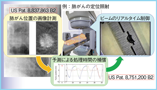 図1　次世代放射線治療機器の知的照射制御のイメージ