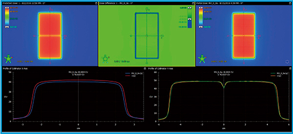 図2　PDIP予測画像とEPID取得画像の比較 上段左がPDIPによるpredicted dose，上段右がEPIDによる測定，上段中央が差を表す。下段左はLR方向，下段右はSI方向のプロファイルを比較したもの。SI方向プロファイル中央付近にT&G効果が現れているのがわかる。