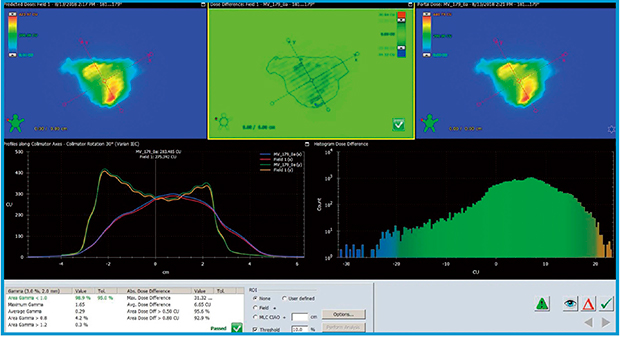 図4　前立腺PDの検証例 上段：左は治療計画装置で計算された予測フルエンス分布，右は実際にEPIDで実測したフルエンス分布，中央は予測と実測のフルエンス分布の線量差。 下段：左はコリメータ軸方向のX-Yプロファイル，右は予測と実測のフルエンス分布の線量差ヒストグラム。 γ解析は許容値γ≧95，クライテリア3％/2mm，thresholdは10％とし，ノーマライズは絶対値を用い，位置補正はローテーションも含めて行っている。