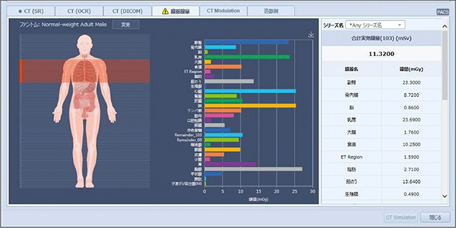 図2　INFINITT DoseMの臓器線量表示画面