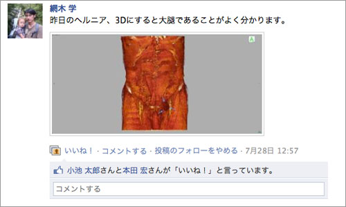 図4　Facebookによる術後の評価