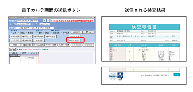 図2　電子カルテ画面送信ボタンと患者さんが受領する検査結果イメージ