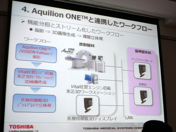 医療用裸眼3Dディスプレイを用いたワークフロー