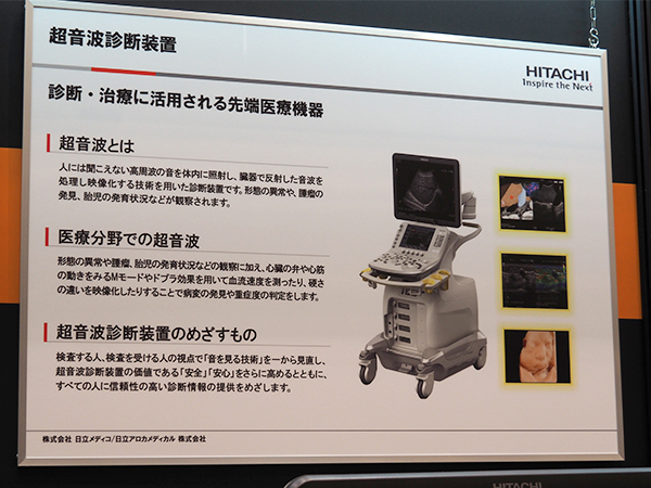 日立アロカメディカルの超音波診断事業の紹介