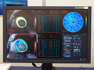 “MR心筋T1マッピング”などのアプリケーションをデモ