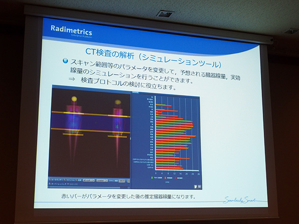 CT検査の線量シミュレーションツールを搭載