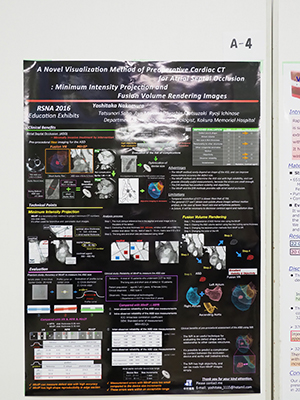 Cum Laude A Novel Visualization Method of Preoperative Cardiac CT for Atrial Septal Occlusion : Minimum Intensity Projection and Fusion Volume Rendering Images 中村義隆 氏（小倉記念病院）