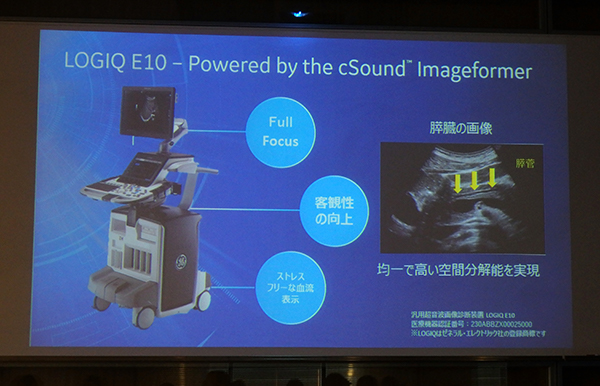 LOGIQ E10の特長