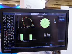 「Vivid E95」は“Myocardial Work”など解析アプリケーションも強化