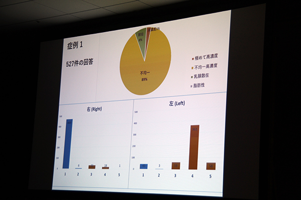 事前読影（乳房の構成とカテゴリー）の集計結果