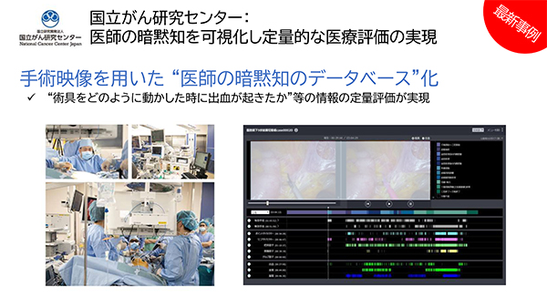 医師の暗黙知を可視化する手術動画データベース