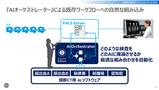 AIを用いた検査・診断のワークフローを自動化するAIオーケストレーター