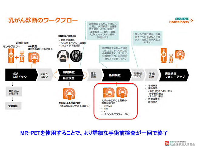 Biograph mMRによるワンストップ術前検査など乳がん診断のワークフローを改善