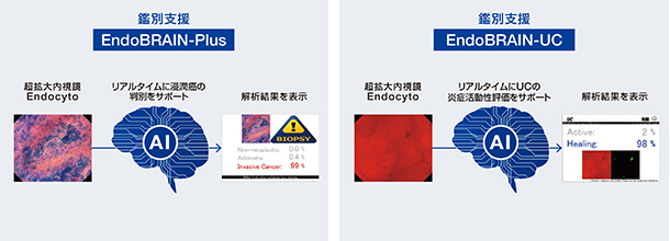 EndoBRAIN-Plus（左）とEndoBRAIN-UC（右）の概要