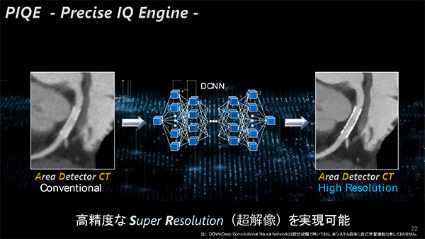 NR画像を超解像技術で高精度なSuper Resolutionを実現する