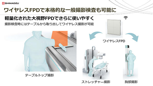 FPDのワイヤレス運用が可能になり，一般撮影検査が容易になった