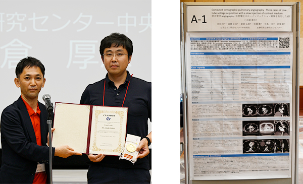 Cum Laude Computed tomographic pulmonary angiography: Three cases of Low-tube-voltage acquisition with a slow injection of contrast medium 肺血管CT-angiography：低管電圧スローインジェクション撮像を施行した3例 瓜倉厚志 氏（国立がん研究センター中央病院）