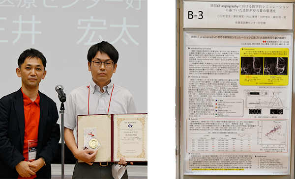 Certificate of Merit 頭部CT angiographyにおける数学的シミュレーションに基づいた造影剤投与量の最適化 三井宏太 氏（佐賀県医療センター好生館）