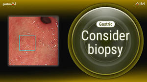 Consider biopsy